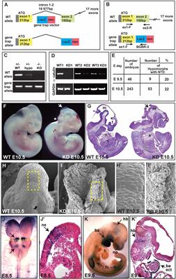 Alpha-Catulin, a New Player in a Rho Dependent Apical Constriction That Contributes to the Mouse Neural Tube Closure